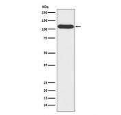 Western blot testing of human A549 cell lysate with OGT antibody. Predicted molecular weight: 110-117 kDa.
