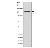 Western blot testing of human MCF7 cell lysate with INPP4B antibody. Predicted molecular weight ~105 kDa.