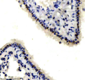 IHC staining of FFPE mouse lung tissue with p73 antibody, HRP-labeled secondary and DAB substrate. HIER: boil tissue sections in pH8 EDTA for 20 min and allow to cool before testing.