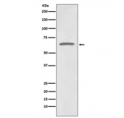Western blot testing of human HeLa cell lysate with p73 antibody. Predicted molecular weight: 70-73 kDa.