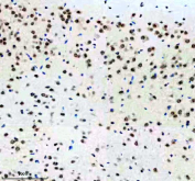 IHC staining of FFPE mouse brain tissue with p73 antibody, HRP-labeled secondary and DAB substrate. HIER: boil tissue sections in pH8 EDTA for 20 min and allow to cool before testing.