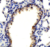 IHC staining of FFPE rat lung tissue with p73 antibody, HRP-labeled secondary and DAB substrate. HIER: boil tissue sections in pH8 EDTA for 20 min and allow to cool before testing.