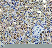 IHC staining of FFPE rat kidney tissue with p73 antibody, HRP-labeled secondary and DAB substrate. HIER: boil tissue sections in pH8 EDTA for 20 min and allow to cool before testing.