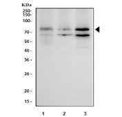 Western blot testing of human 1) ThP-1, 2) U-2 OS and 3) Caco-2 cell lysate with p73 antibody. Expected molecular weight: 70-73 kDa.