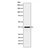 Western blot testing of human Y79 cell lysate with CRX antibody. Predicted molecular weight ~32 kDa.