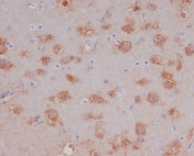 IHC staining of FFPE mouse brain tissue with HSPA12A antibody. HIER: boil tissue sections in pH6, 10mM citrate buffer, for 10-20 min and allow to cool before testing.