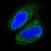 IF/ICC staining of human A431 cells with TAK1 antibody (green) and DAPI nuclear stain (blue).