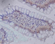IHC staining of FFPE human colon tissue with Musashi 1 antibody. HIER: boil tissue sections in pH6, 10mM citrate buffer, for 10-20 min and allow to cool before testing.