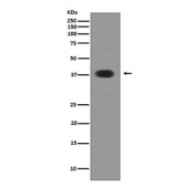 Western blot testing of human SH-SY5Y cell lysate with Musashi 1 antibody. Predicted molecular weight ~39 kDa.