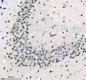 Immunohistochemical analysis of MSI1 using anti-MSI1 antibody. MSI1 is detected in a paraffin-embedded section of mouse brain tissue. Heat-mediated antigen retrieval was performed in EDTA buffer (pH 8.0). Positive nuclear and cytoplasmic staining is observed in a subset of brain cells, consistent with reported MSI1 expression patterns.