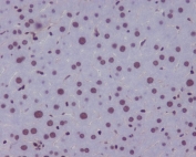 IHC staining of FFPE mouse liver tissue with KLF4 antibody. HIER: boil tissue sections in pH8 EDTA for 20 min and allow to cool before testing.