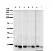 Western blot testing of 1) human HeLa, 2) human 293, 3) mouse spleen, 4) rat liver, 5) rat spleen, 6) mouse stomach and 7) mouse testis tissue lysate with BCL2L11 antibody. Predicted molecular weight: 12-22 kDa (three isoforms).