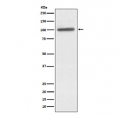 Western blot testing of human A431 cell lysate with ACTN4 antibody. Predicted molecular weight ~105 kDa.