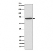 Western blot testing of human fetal liver lysate with Perilipin 1 antibody at 0.5ug/ml. Expected molecular weight: 56-62 kDa.