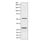 Western blot testing of human Jurkat cell lysate with PARK2 antibody. Expected molecular weight: 50-60 kDa with multiple smaller isoforms (possible ~30 kDa isoform visualized here).