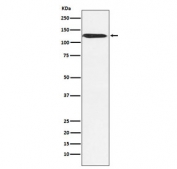 Western blot testing of human MCF7 cell lysate with SMARCA5 antibody. Predicted molecular weight ~122 kDa.