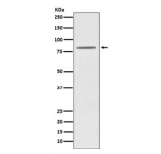 Western blot testing of human HeLa cell lysate with OPA1 antibody. Predicted molecular weight: 111-120 kDa with multiple smaller isoforms from 81-95 kDa.