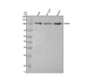 KDM1A / LSD1 Antibody Cell Lysate WB. Western blot analysis of human SAHA, SH-SY5Y, and HepG2 cell lysates using KDM1A / LSD1 Antibody / Histone Demethylase clone DID-11. A predominant band is detected at approximately 100 kDa, consistent with the expected apparent molecular weight of Lysine-specific demethylase 1 / KDM1A, a chromatin-associated histone demethylase involved in epigenetic transcriptional regulation.