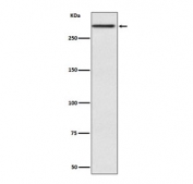 Western blot testing of human fetal kidney with Cubilin antibody. Expected molecular weight: 399-460 kDa.