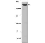 Western blot testing of human fetal kidney with Cubilin antibody. Expected molecular weight: 399-460 kDa.
