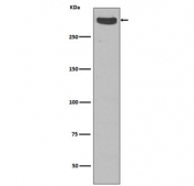 Western blot testing of human fetal kidney with Cubilin antibody. Expected molecular weight: 399-460 kDa.