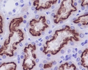 IHC staining of FFPE human kidney tissue with CUBN antibody. HIER: boil tissue sections in pH6, 10mM citrate buffer, for 10-20 min and allow to cool before testing.