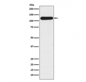 Western blot testing of human HepG2 lysate with BUB1B antibody. Predicted molecular weight ~120 kDa.