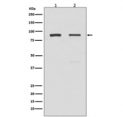 Western blot testing of human 1) A549 and 2) HeLa lysate with TLR2 antibody. Predicted molecular weight: 85-90 kDa.