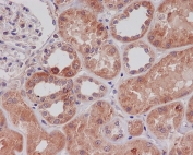 IHC staining of FFPE human kidney tissue with TLR2 antibody. HIER: boil tissue sections in pH6, 10mM citrate buffer, for 10-20 min and allow to cool before testing.