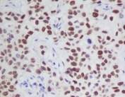 IHC staining of FFPE human tissue with phospho-JAK2 antibody. HIER: boil tissue sections in pH6, 10mM citrate buffer, for 10-20 min and allow to cool before testing.