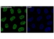 Immunofluorescent staining of FFPE human HeLa cells with Brd4 antibody. HIER: boil tissue sections in pH6, 10mM citrate buffer, for 10-20 min and allow to cool before testing.