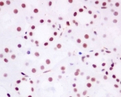 IHC staining of FFPE human kidney tissue with Brd4 antibody. HIER: boil tissue sections in pH6, 10mM citrate buffer, for 10-20 min and allow to cool before testing.