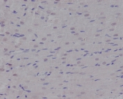 IHC staining of FFPE rat heart tissue with NBS1 antibody. HIER: boil tissue sections in pH6, 10mM citrate buffer, for 10-20 min and allow to cool before testing.