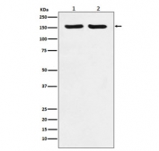 Western blot testing of 1) human HeLa and 2) mouse RAW264 lysate with ROCK2 antibody. Predicted molecular weight ~161 kDa.