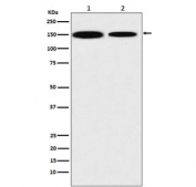 Western blot testing of 1) human HEK293 and 2) mouse NIH3T3 lysate with KDM4A antibody. Predicted molecular weight ~121 kDa.