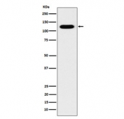 Western blot testing of human fetal kidney lysate with Cadherin 16 antibody. Expected molecular weight: 90-130 kDa.