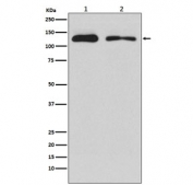 Western blot testing of 1) human HEK293 and 2) rat PC-12 cell lysate with ULK1 antibody. Predicted molecular weight: 112-150 kDa.
