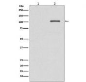 Western blot testing of lysate from 1) untreated and 2) AP-treated human K562 cells with phospho-IRE1 antibody. Predicted molecular weight ~110 kDa.