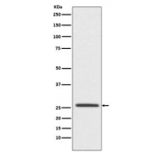 Western blot testing of human SH-SY5Y cell lysate with Claudin 11 antibody. Predicted molecular weight ~22 kDa.