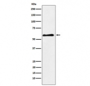 Western blot testing of human fetal brain lysate with PAK3 antibody. Predicted molecular weight ~62 kDa.