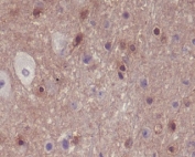 IHC staining of FFPE mouse brain with phospho-PAK1/2/3 antibody. HIER: boil tissue sections in pH6, 10mM citrate buffer, for 10-20 min and allow to cool before testing.
