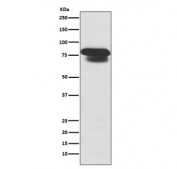 Western blot testing of human HepG2 cell lysate with PIAS1/2/3 antibody. Predicted molecular weight: ~72 kDa (PIAS1) and ~68 kDa (PIAS2 & 3).