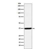 Western blot testing with DDAH1 antibody. Expected molecular weight: 31-38 kDa.