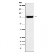 Western blot testing of human HeLa cell lysate with MTA2 antibody. Predicted molecular weight ~75 kDa.