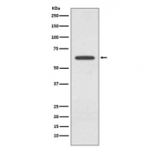 Western blot testing of human 293T cell lysate with Glutaminase antibody. Predicted molecular weigh: 65-73 kDa.