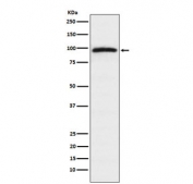 Western blot testing of human HeLa cell lysate with Epac1 antibody. Predicted molecular weight ~104 kDa.