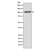 Western blot testing of human A431 cell lysate with AP2A1 antibody. Predicted molecular weight ~108 kDa.