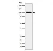 Western blot testing with RIG-I antibody. Expected molecular weight: 106-115 kDa.