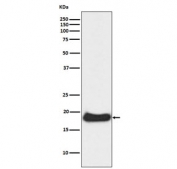 Western blot testing of human A431 cell lysate with CLDN1 antibody. Expected molecular weight: 20-23 kDa.