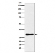Western blot testing of human MCF7 cell lysate with DDAH2 antibody. Predicted molecular weight ~29 kDa.